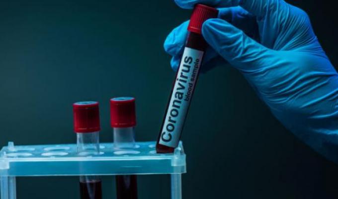 Лабораторно підтверджено три нових випадки COVID-19 в області