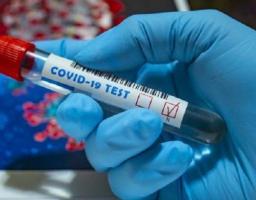 За добу лабораторно підтверджено 46 нових випадків COVID-19 в області. Померло шість осіб 