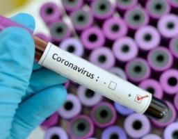 Лабораторно підтверджено 232 нових випадки COVID-19 в області. Від ускладнень померло дві людини. В Україні – 421